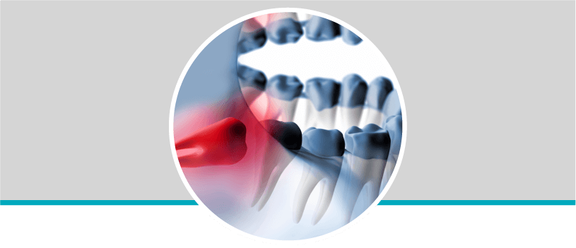 Cirugía oral y maxilofacial