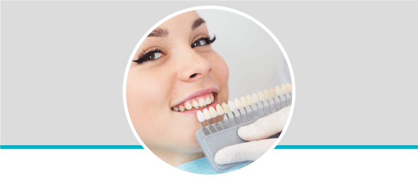 Diseño de sonrisa