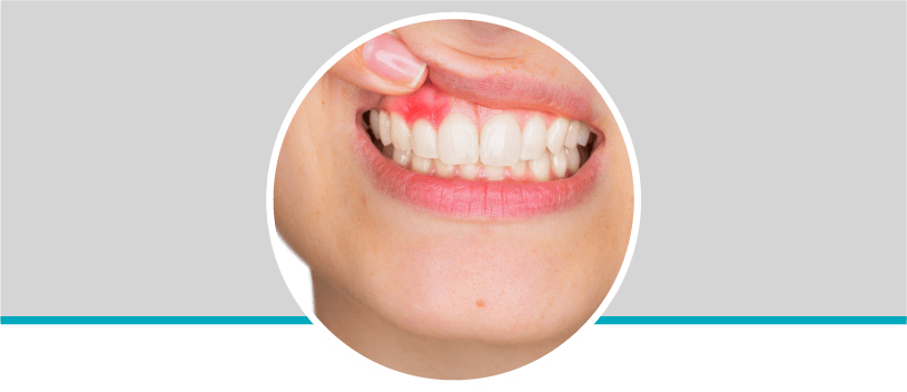 Periodoncia