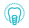 Implantes dentales